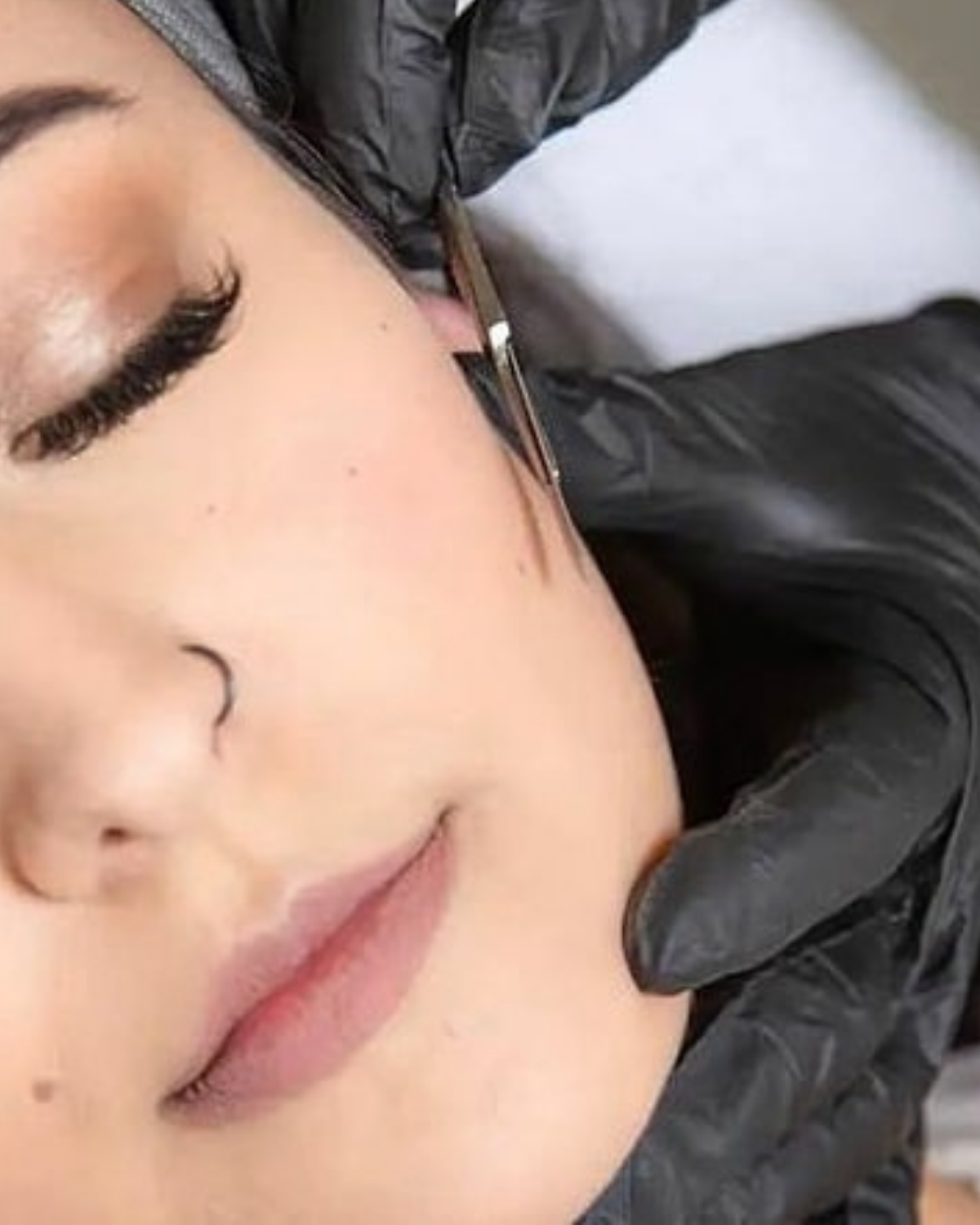 Dermaplaning
